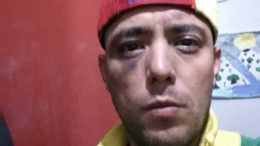 El periodista venezolano Jesús Medina denunció el trato sufrido durante los tres días de cautiverio. (@jesusmedinae)