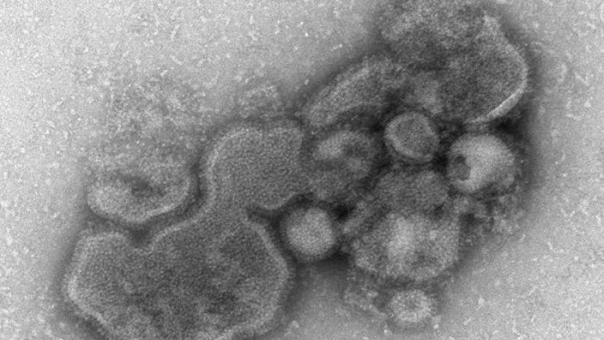 Imagen del virus de la gripe H1N1. (Centers for Disease Control and Prevention)