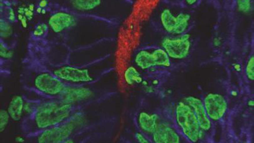 Inmunofluorescencia del tejido gÃ¡strico, con la presencia de Pdx1 (verde), H. pylori (rojo) y E-cadherina (azul) / McCracken