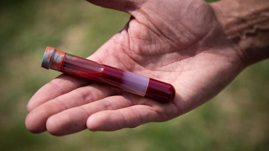 Se extrajeron glóbulos blancos de muestras de sangre de elefantes y se sometió a las células a tratamientos que dañan el ADN. (Utah University)