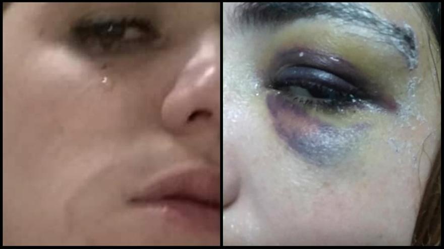 La joven, Virgen Martínez, fue agredida después de rechazar las pretensiones sexuales de un desconocido que la abordó en la calle. (La Hora de Cuba)